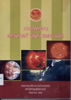 ภาพปกที่กำหนดเอง